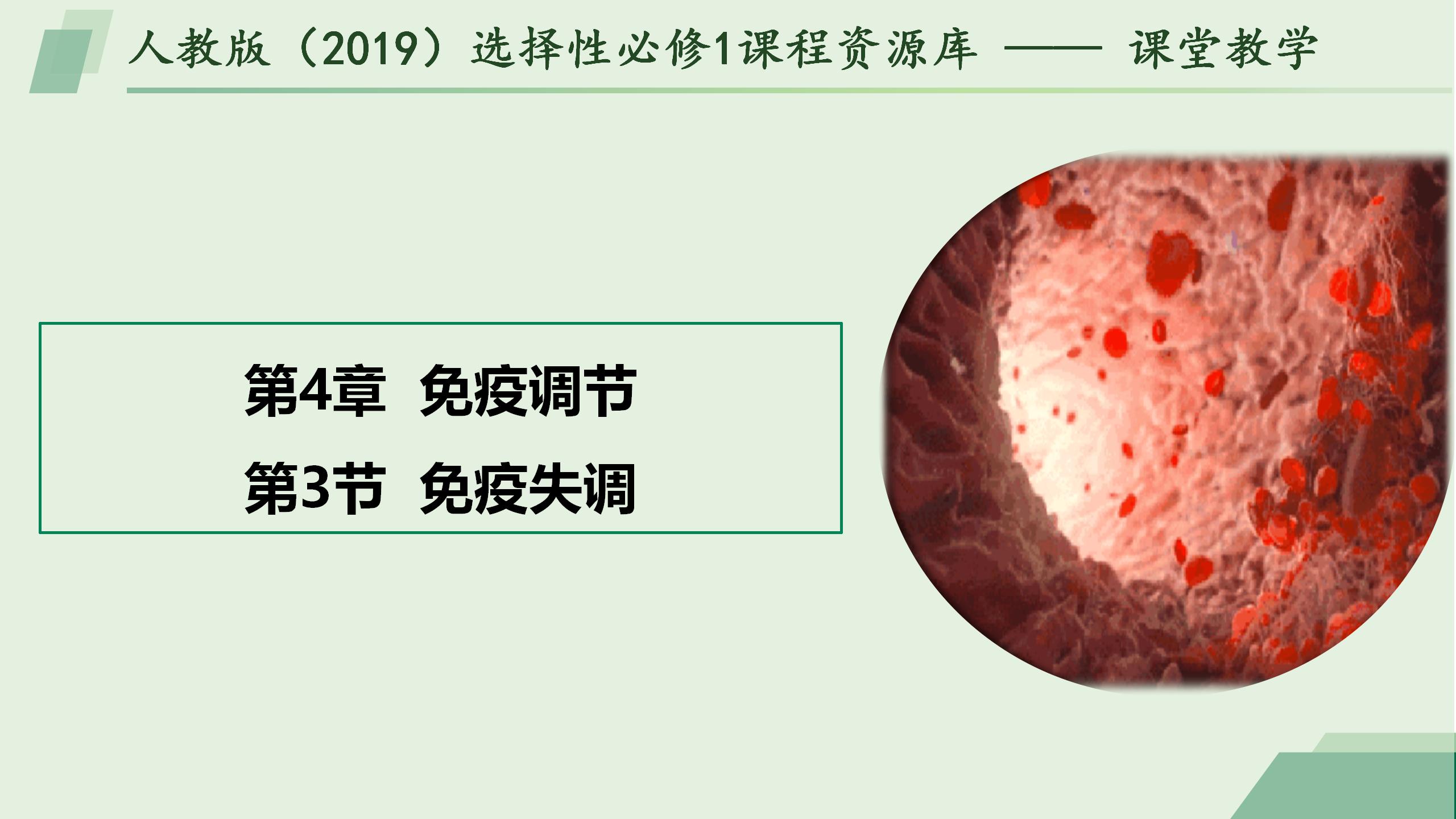 4.3免疫失调